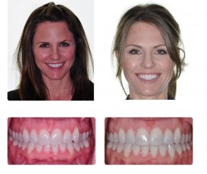 Klein & Walker Orthodontics