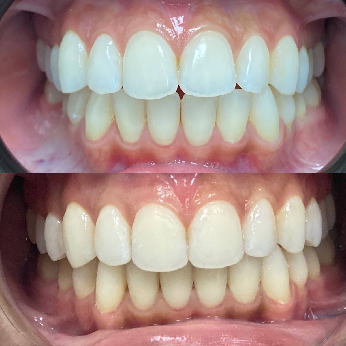 Blossom Smiles Dental