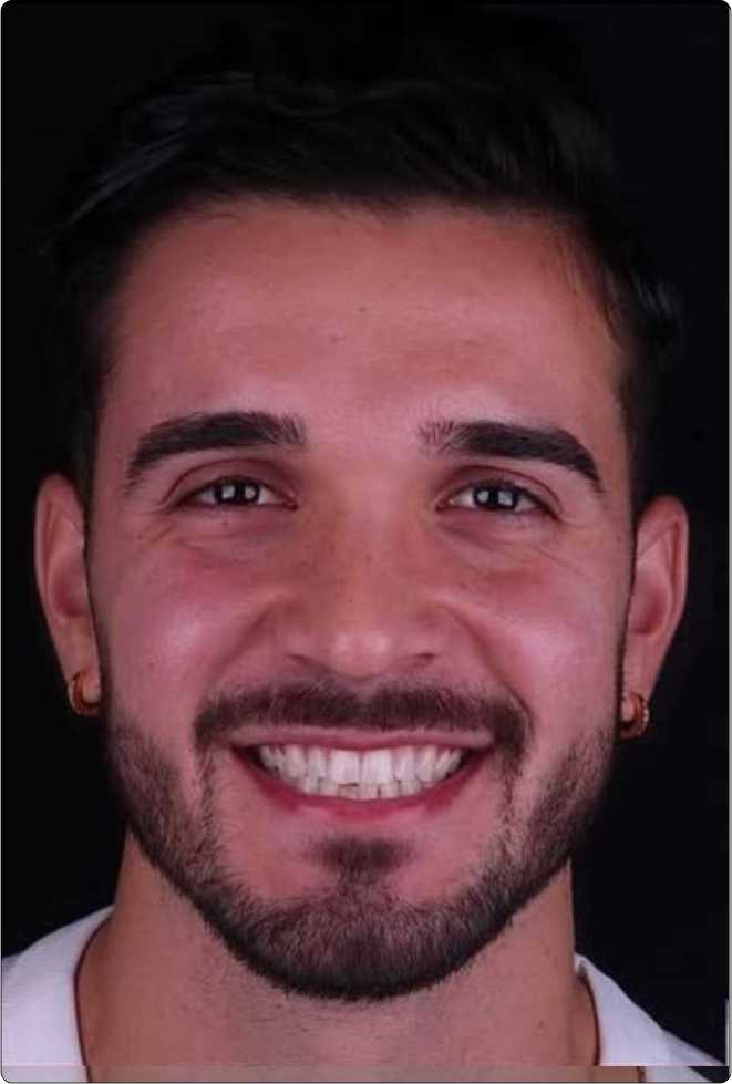 Dubai Smile Dental Clinic -Mirdif Branch