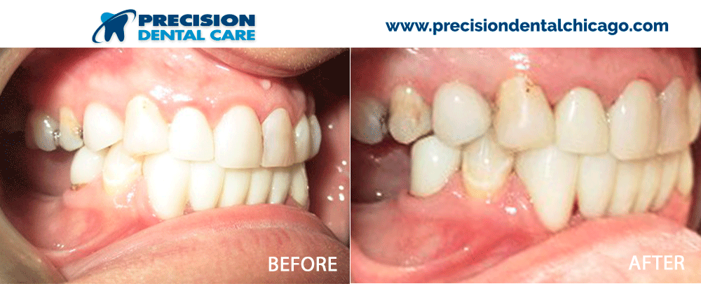 Precision Dental Care Chicago