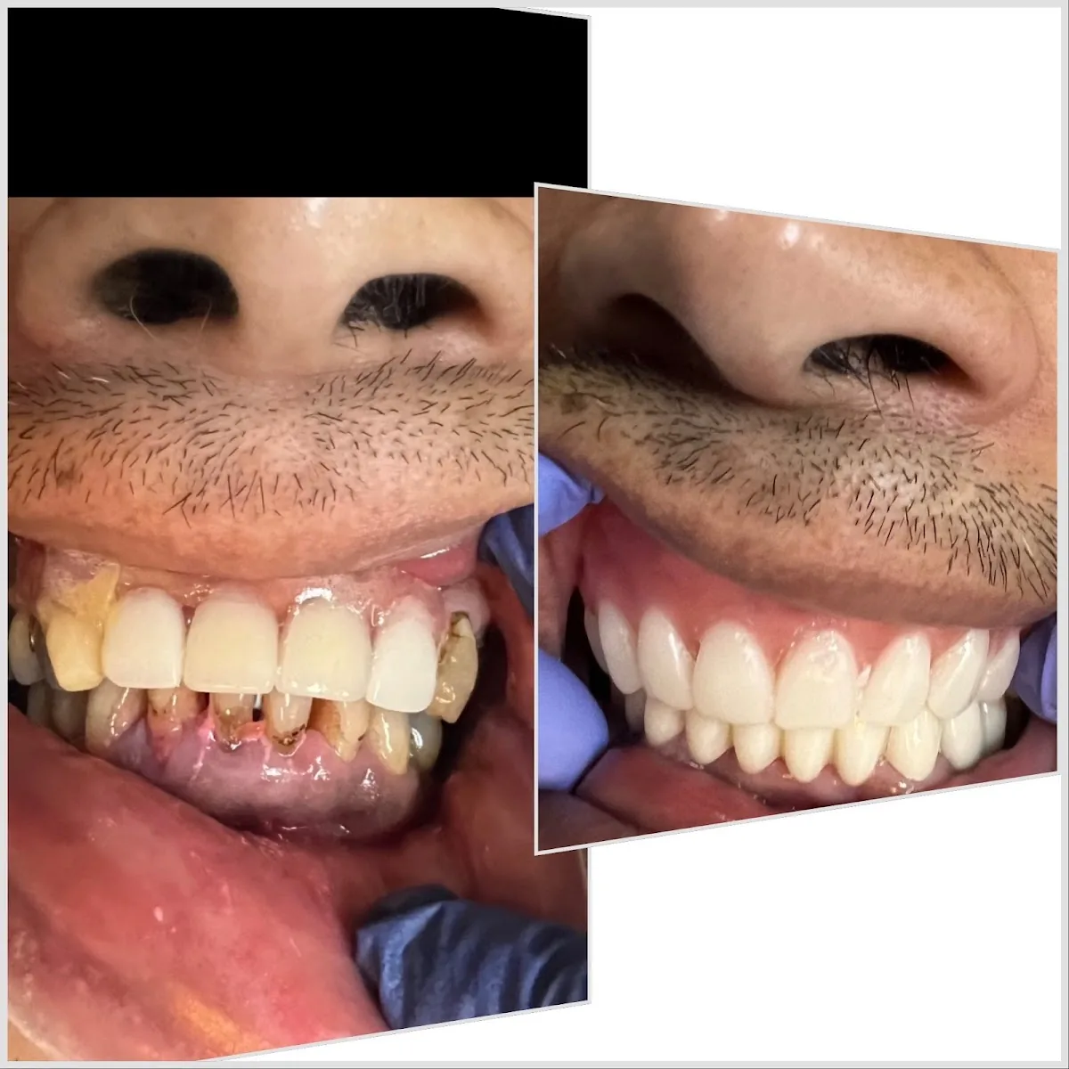 Laser Regen & Implant Center