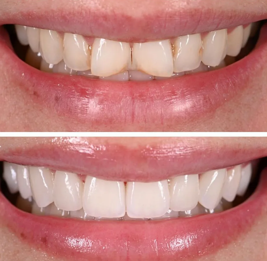 South Lincoln Family Dentistry - Nebraska Family Dentistry