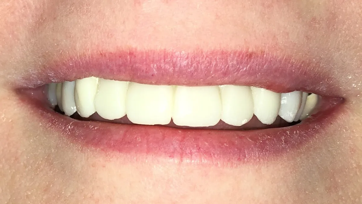 Turlock Dentistry And Implants