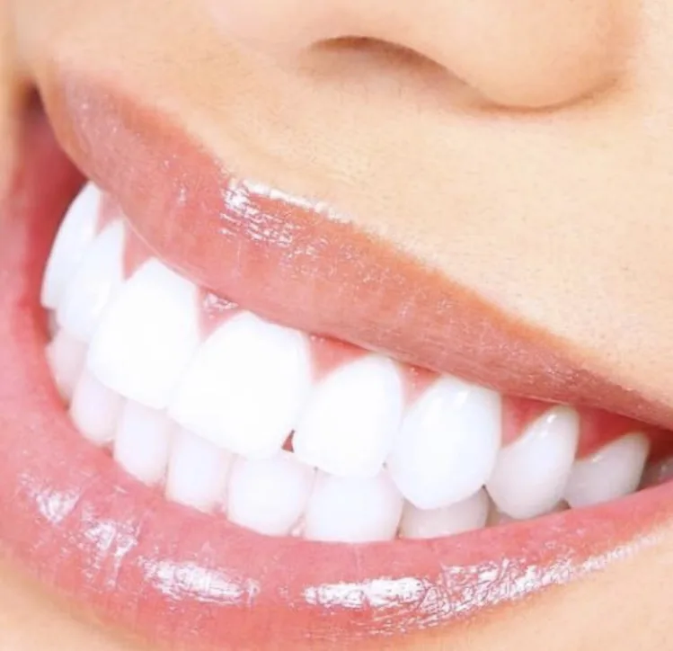 Teeth Whitening Spa 2