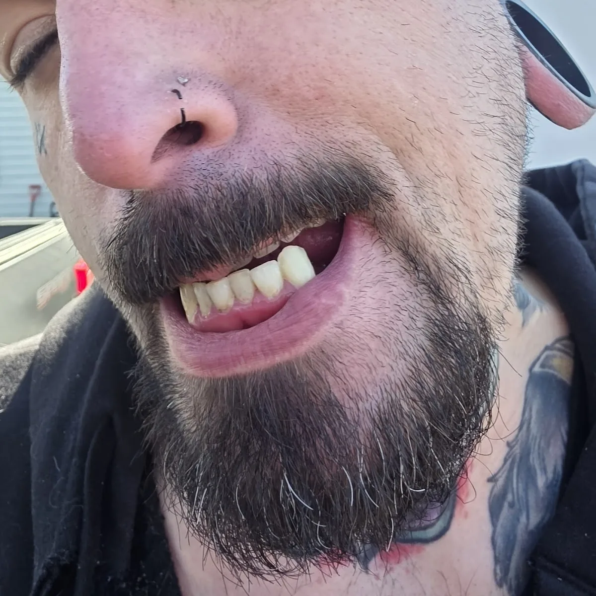 Better Smile