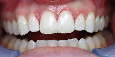 Dental Arts of Boston | Dr. George Stevens and Associates