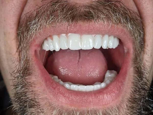 New Life Dental Implant Center