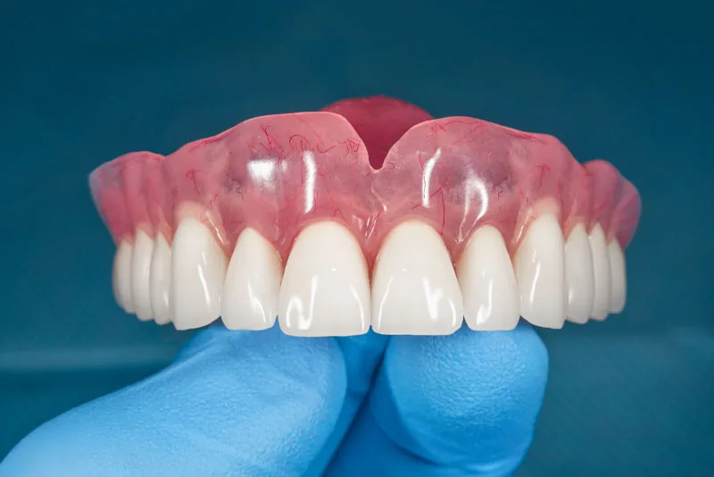 Best Value Dentures and Implants Palmetto Bay