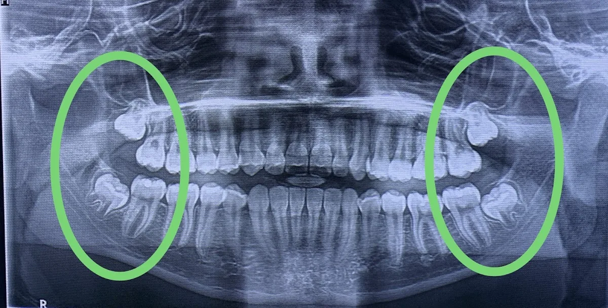 Dr. Johanny Caceres. Oral & Facial Surgery Of Miami