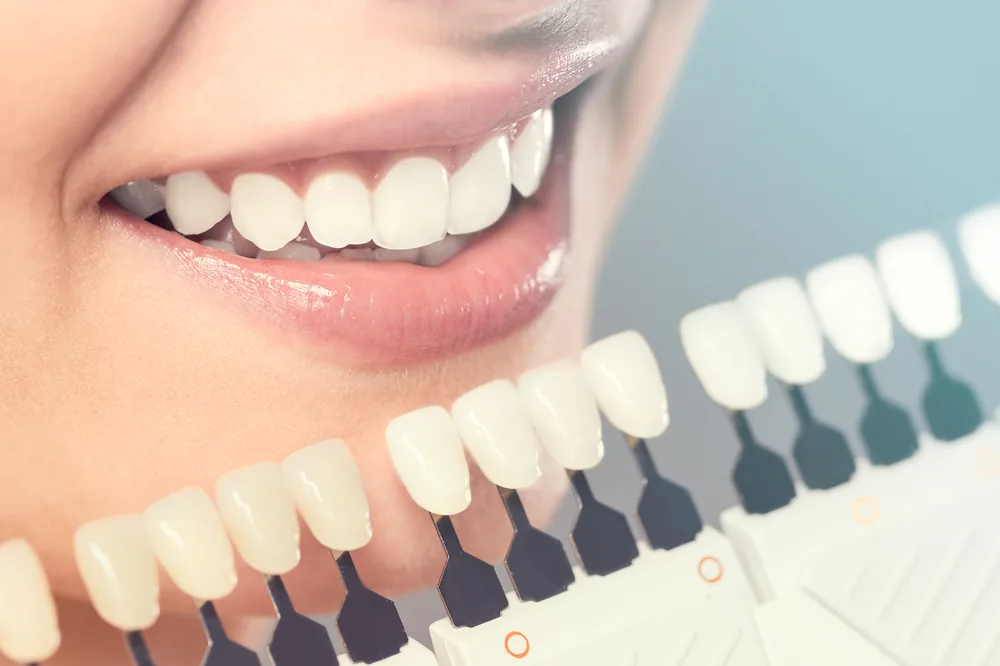Contemporary Periodontics