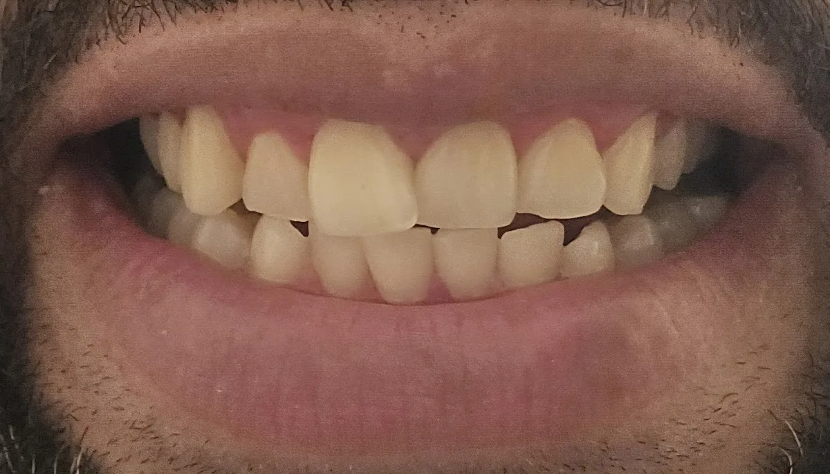 James Ransdell Dental Care, Psc