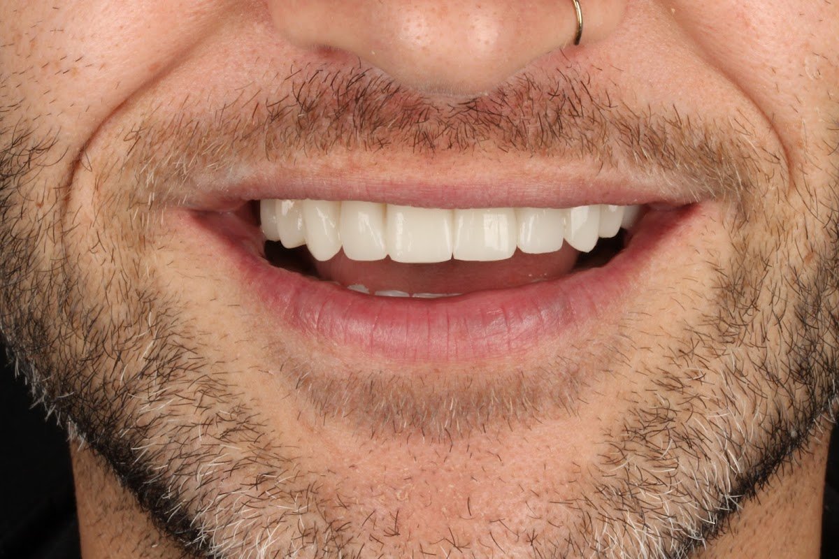 Dentalvana