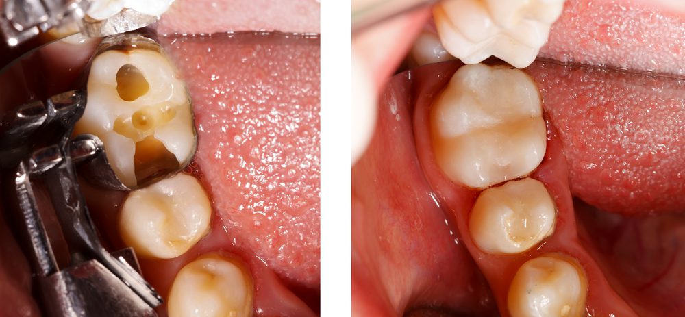 Merlo & Fahrney Dentistry